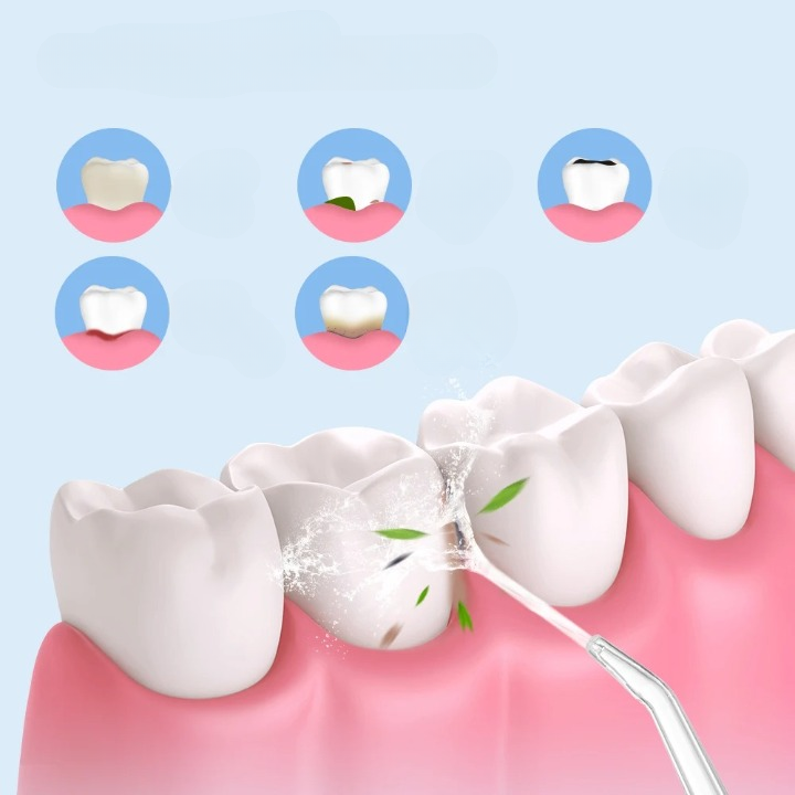 Hydrofloss – Effektiv tandvård i flytande form
